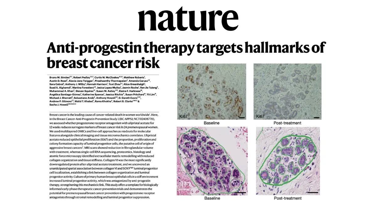 images Una nuova terapia contro il tumore al seno: pubblicata su Nature la ricerca del gruppo Unical 