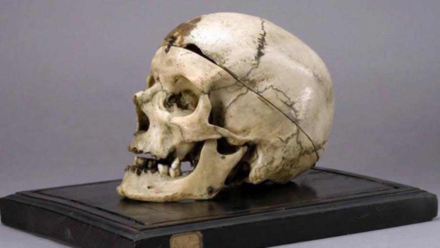 Cranio del Museo Lombroso. La Cassazione definì giusto conoscerne le teorie  images Cranio del Museo Lombroso. La Cassazione definì giusto conoscerne le teorie