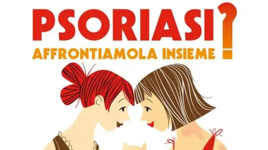 “Psoriasi? affrontiamola insieme”, screening gratuiti al Policlinico di Catanzaro images “Psoriasi? affrontiamola insieme”, screening gratuiti al Policlinico di Catanzaro