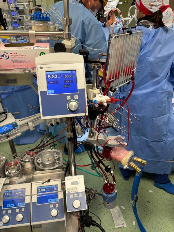 Cardiochirurgia “Dulbecco” di Catanzaro e Tecnologie avanzate: avviato programma “mini-circolazione extracorporea” unico in tutto il sud-Italia