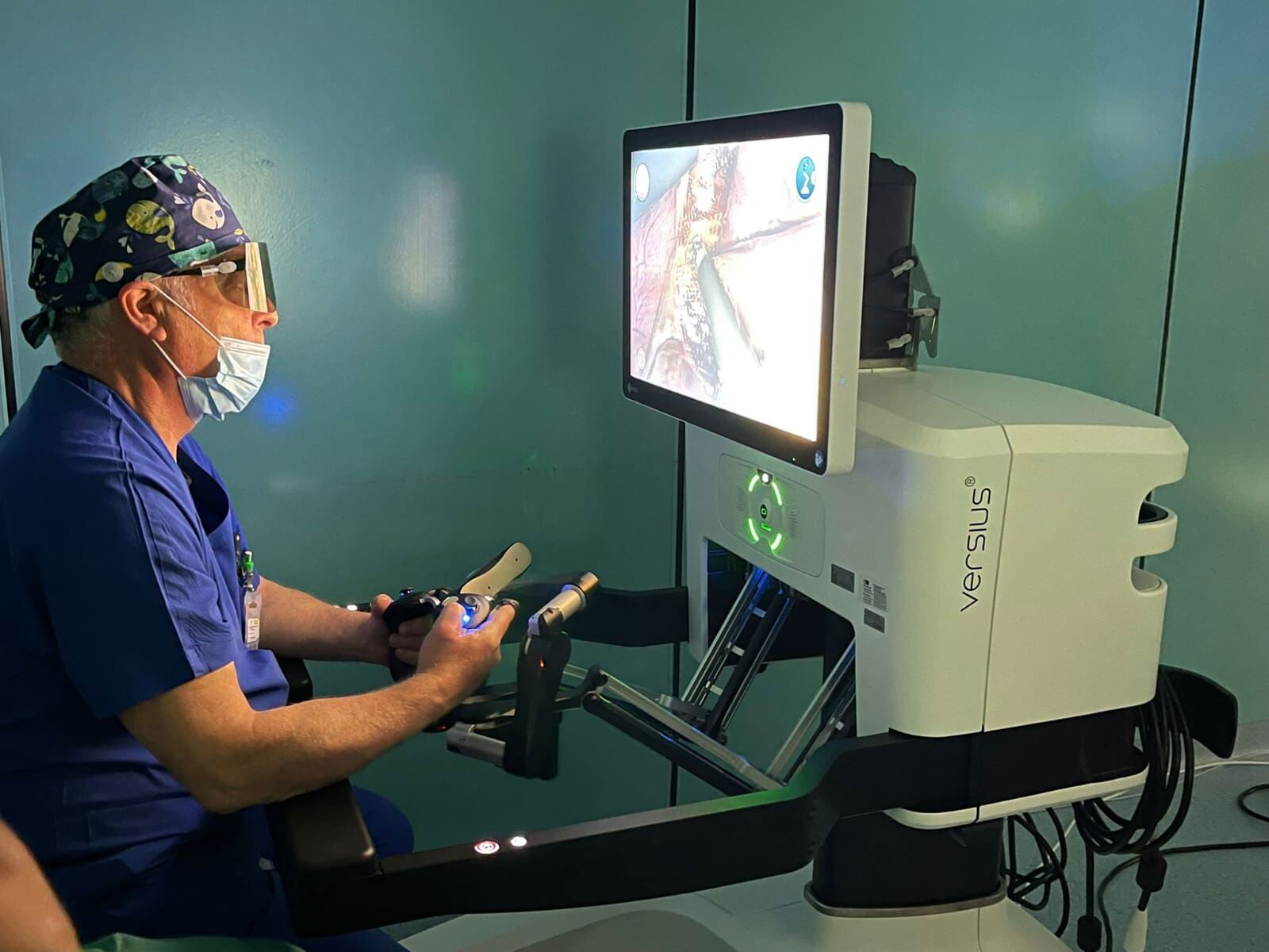 L'Asp di Catanzaro avvia la chirurgia di precisione con il sistema robotico "Versius" a Lamezia Terme images L'Asp di Catanzaro avvia la chirurgia di precisione con il sistema robotico "Versius" a Lamezia Terme