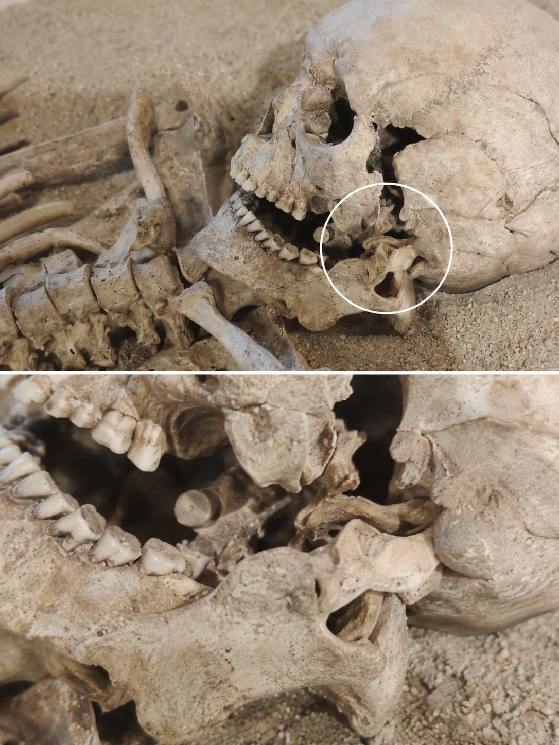 Montauro custodisce un tesoro della medicina antica: una mandibola ricostruita tra il XVI e il XVII secolo