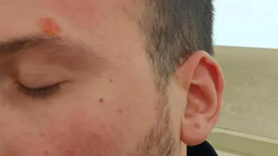 Frattura la mano ad un agente, viene scarcerato e picchia altri poliziotti. Fsp: “Impossibile fare sicurezza” images Frattura la mano ad un agente, viene scarcerato e picchia altri poliziotti. Fsp: “Impossibile fare sicurezza”