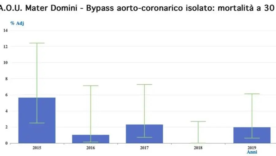 images Cardiochirurgia al “Mater Domini” della 'Dulbecco' tra le prime10 in Italia per bypass aorto-coronarico 