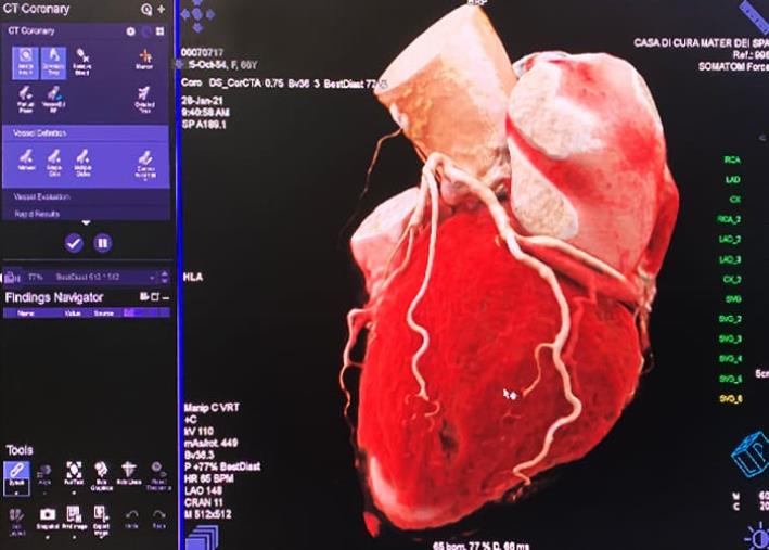 images AI’M DIAGNOSTIC Innovazione in Calabria: il 27 giugno il viaggio sulla diagnostica cardiaca continua