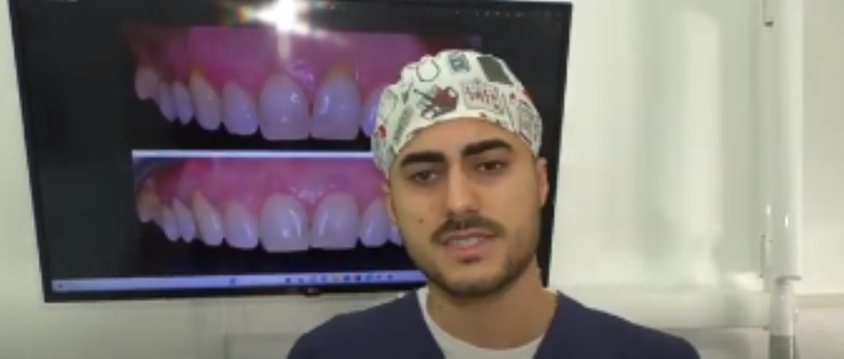 images L'odontoiatra Giuseppe Mellace (Namastè): "Cosa fare quando le gengive si ritirano" 