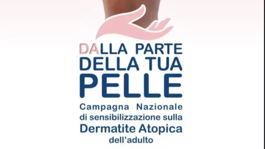 Gli Open Day sulla dermatite atopica tornano in Calabria: consulti gratuiti a Catanzaro, Reggio e Cosenza images Gli Open Day sulla dermatite atopica tornano in Calabria: consulti gratuiti a Catanzaro, Reggio e Cosenza