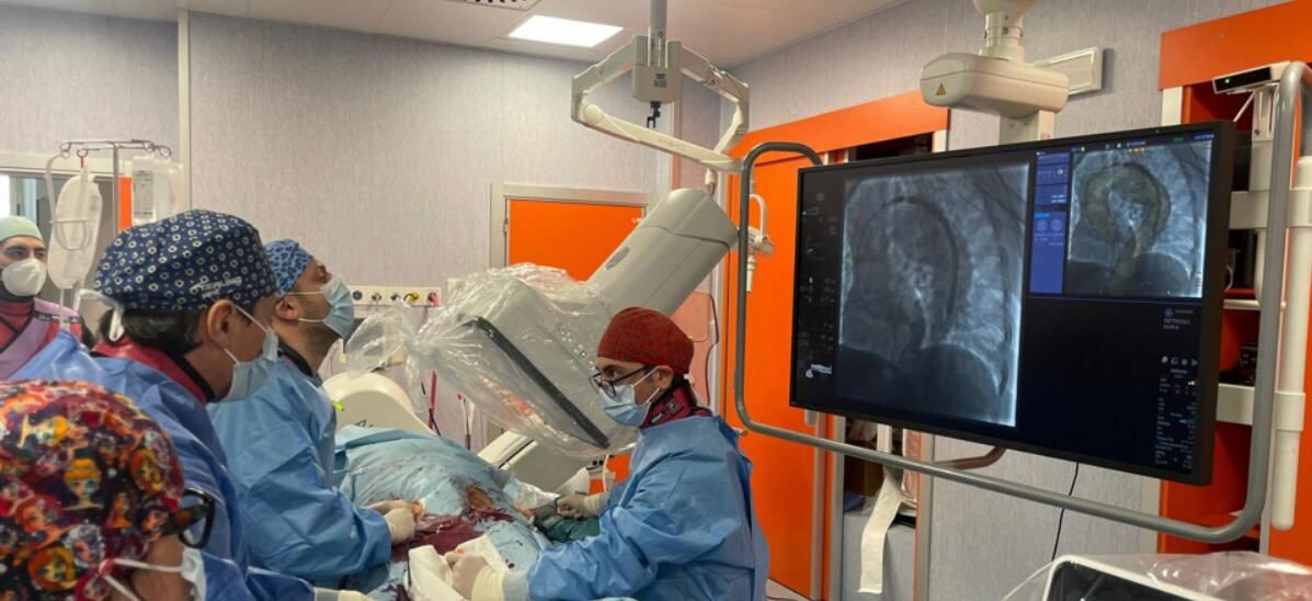 images All'Annunziata di Cosenza il primo innovativo intervento sull'arco aortico senza chirurgia open