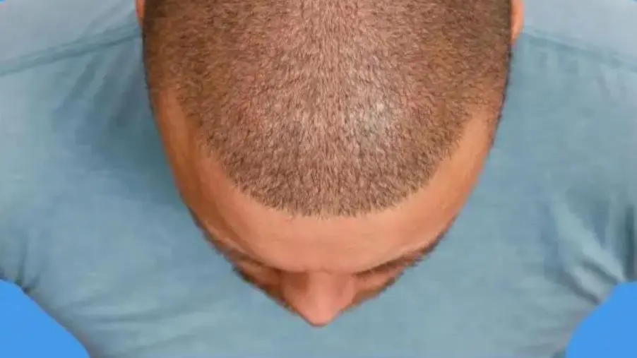 Tricomedit Group: scopriamo il primo centro tricologico d’Italia images Tricomedit Group: scopriamo il primo centro tricologico d’Italia