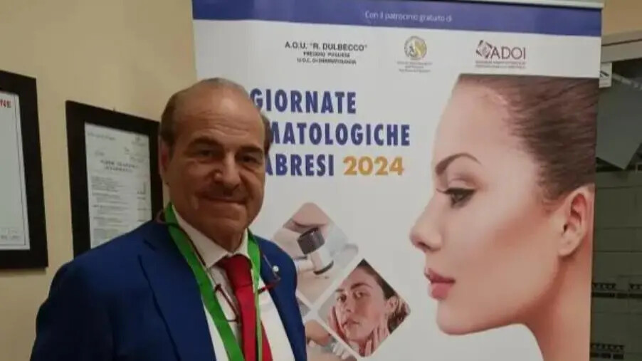 images Catanzaro, "Psoriasi e Dermatite atopica" alla prima delle 2 giornate Dermatologiche calabresi 2024 