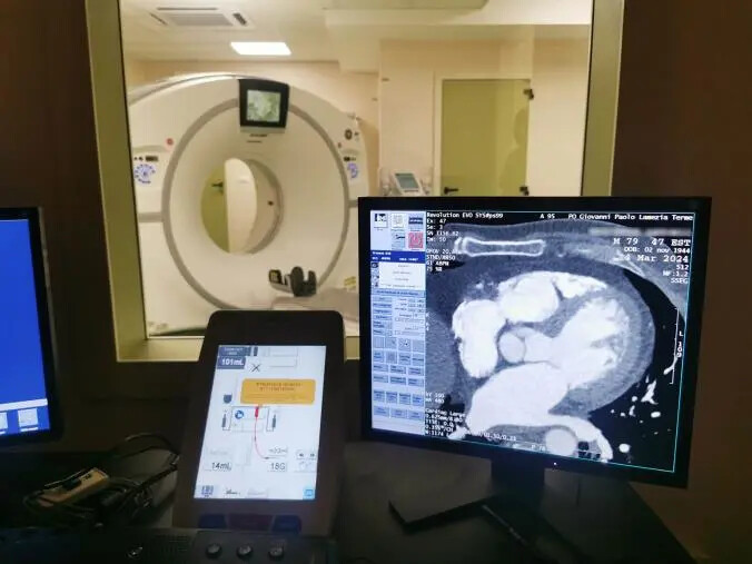 images Attiva la nuova Cardio TAC di ultimissima generazione nel presidio di Lamezia