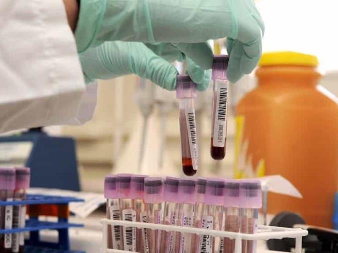 Covid. La Regione aderisce al progetto europeo per la raccolta del plasma images Covid. La Regione aderisce al progetto europeo per la raccolta del plasma