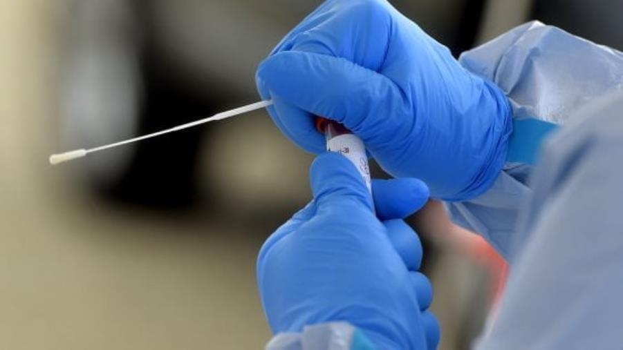images Ordinanza sui laboratori privati: tampone molecolare a 61,59 euro e obbligo di notifica dei test rapidi 