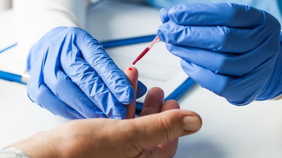 images Coronavirus. Ad Albi 71 positivi dai test rapidi: ora si attende la conferma dell'esame molecolare 